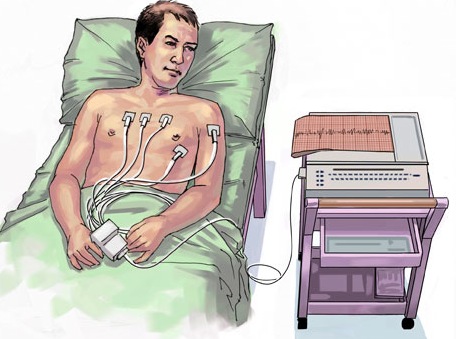 Electrocardiograma